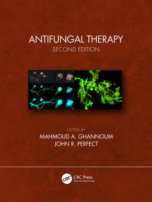 cover image of Antifungal Therapy